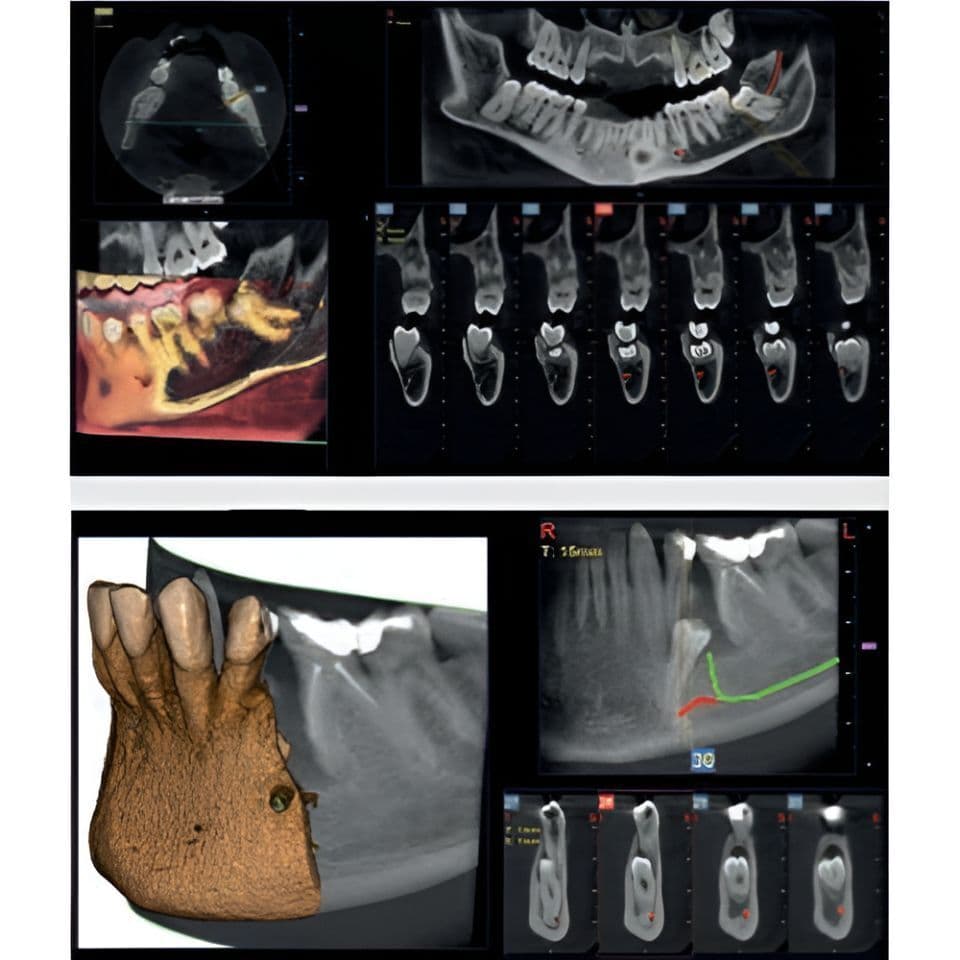 MyRay Hyperion X9 PRO Pan/Ceph/CBCT Dental X-Ray with 13x16 FOV thumbnail 4