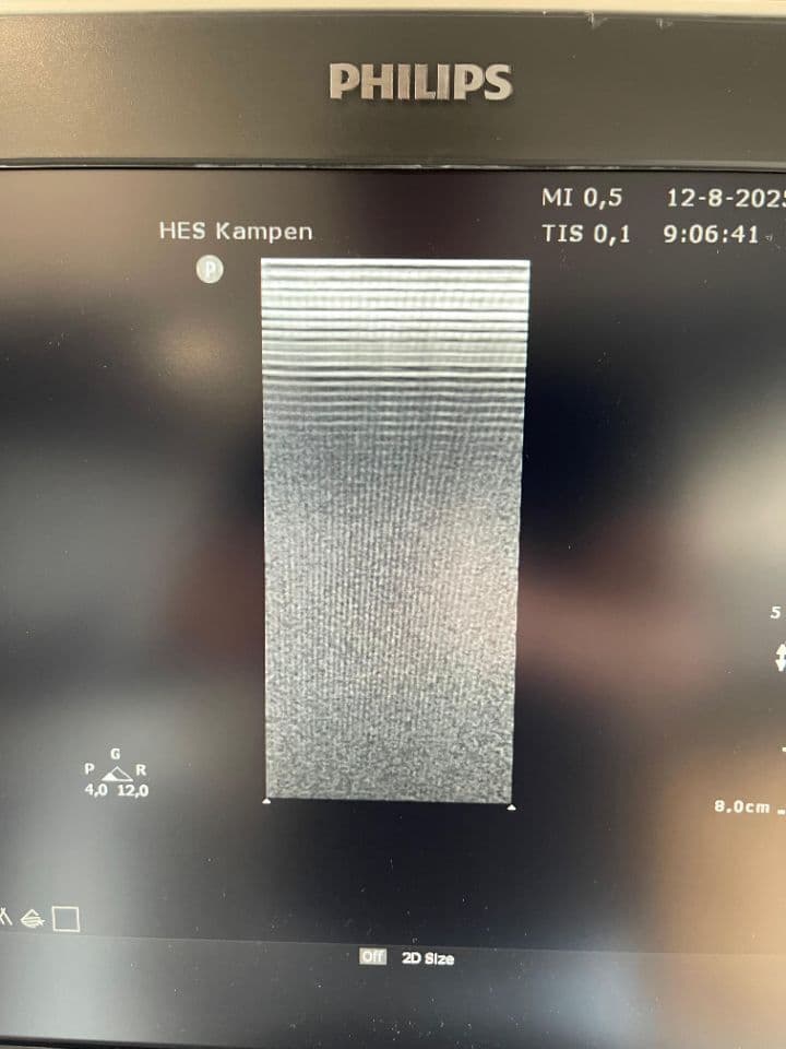 Philips Sparq Ultrasound System thumbnail 8