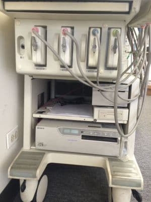 Toshiba PowerVision 6000 Digital Ultrasound System thumbnail 2