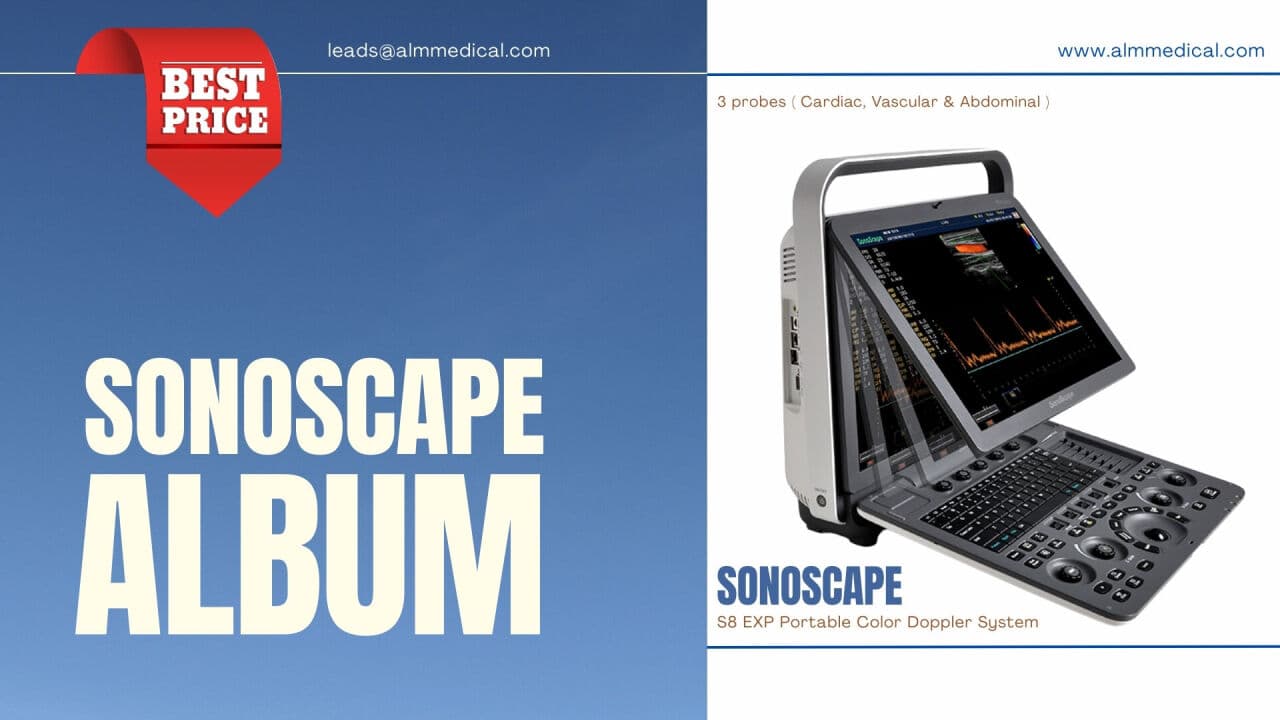 SonoScape S8 Portable Ultrasound System for Cardiac & Vascular Imaging
