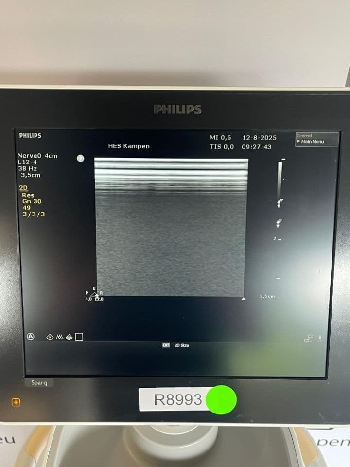 Philips Sparq Ultrasound System thumbnail 4