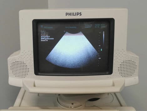 Abdominal and OB/GYN Ultrasound Transducer — Philips C5-2 thumbnail 6