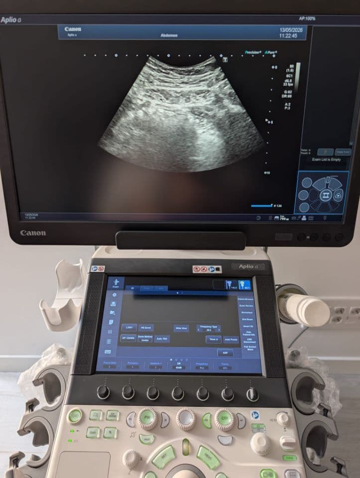 Toshiba Aplio A Diagnostic Ultrasound System thumbnail 9