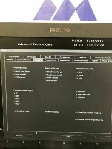 Philips ClearVue 650 3D/4D Women's Health Ultrasound System thumbnail 3