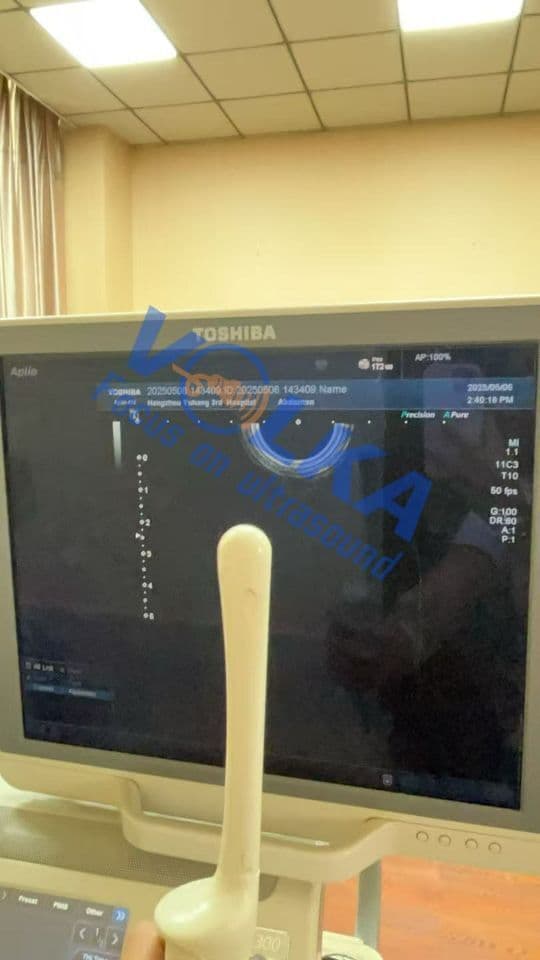 Toshiba PVT-781VT Endocavitary Ultrasound Transducer thumbnail 4