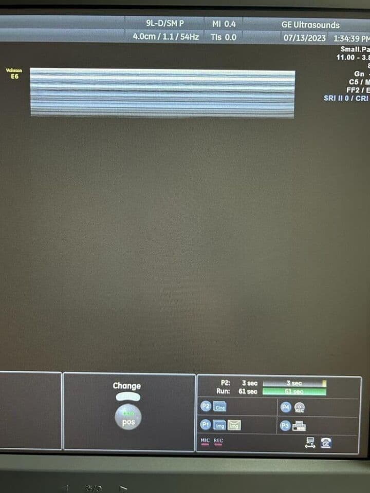 GE 9L-D Linear Array Ultrasound Transducer thumbnail 3