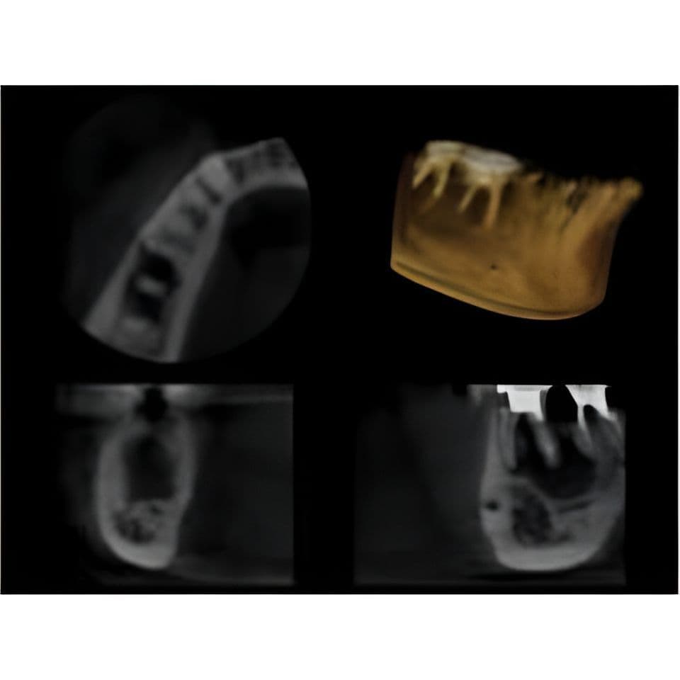 Carestream CS9000 Pan/CBCT 3D Dental X-Ray System thumbnail 6
