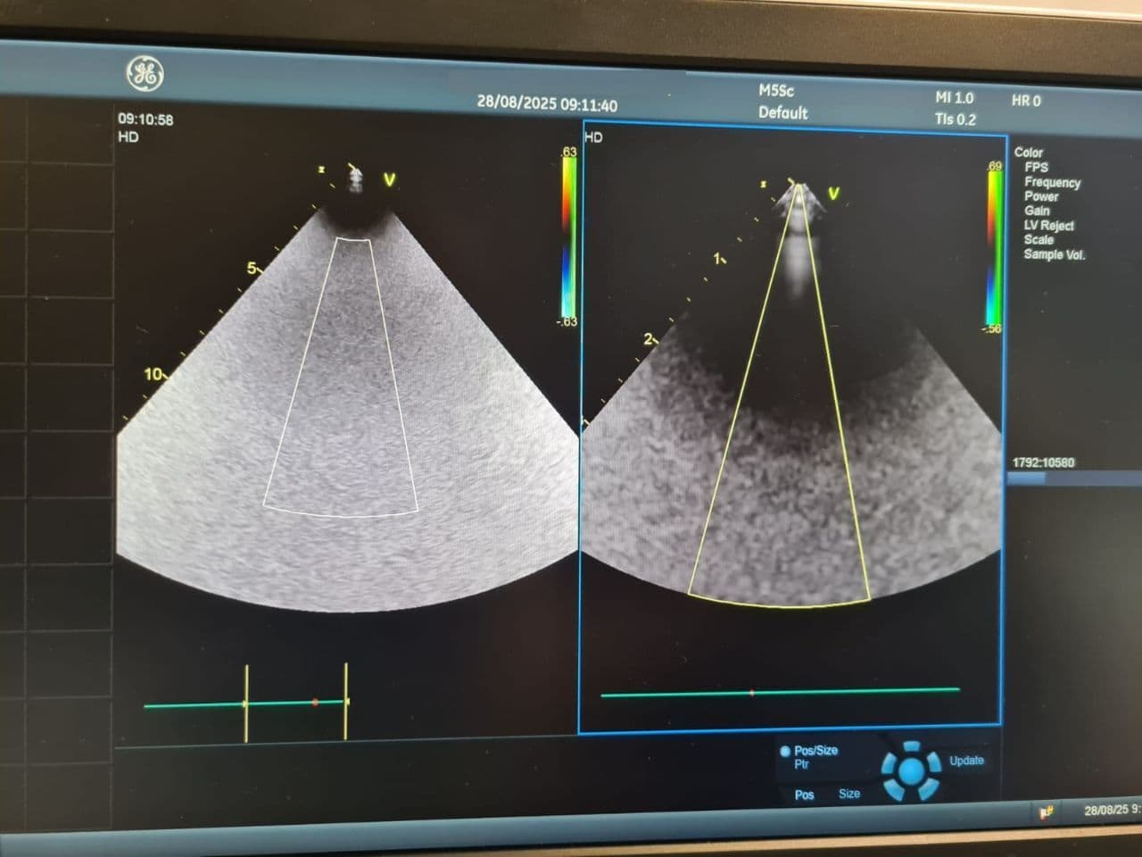 GE Healthcare M5Sc-D Ultrasound Transducer thumbnail 3