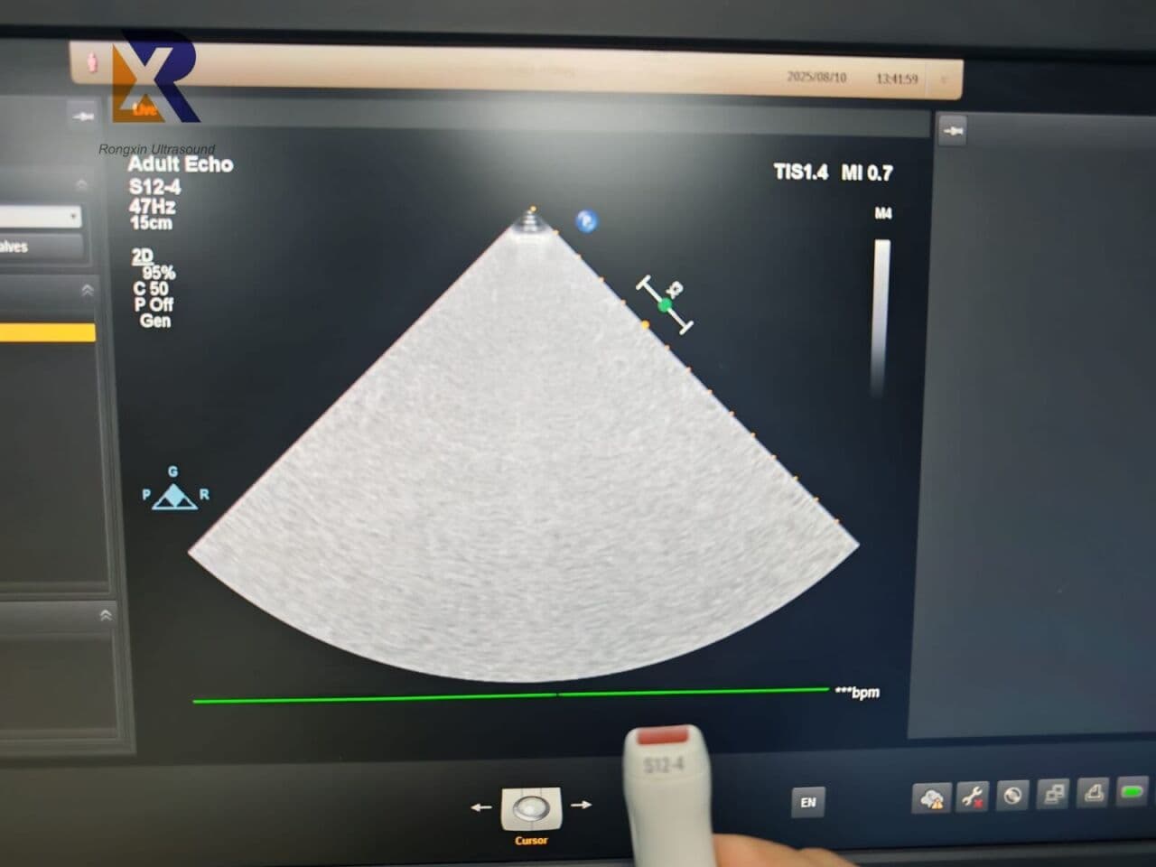 Philips EPIQ 7G Premium General Ultrasound Machine thumbnail 3