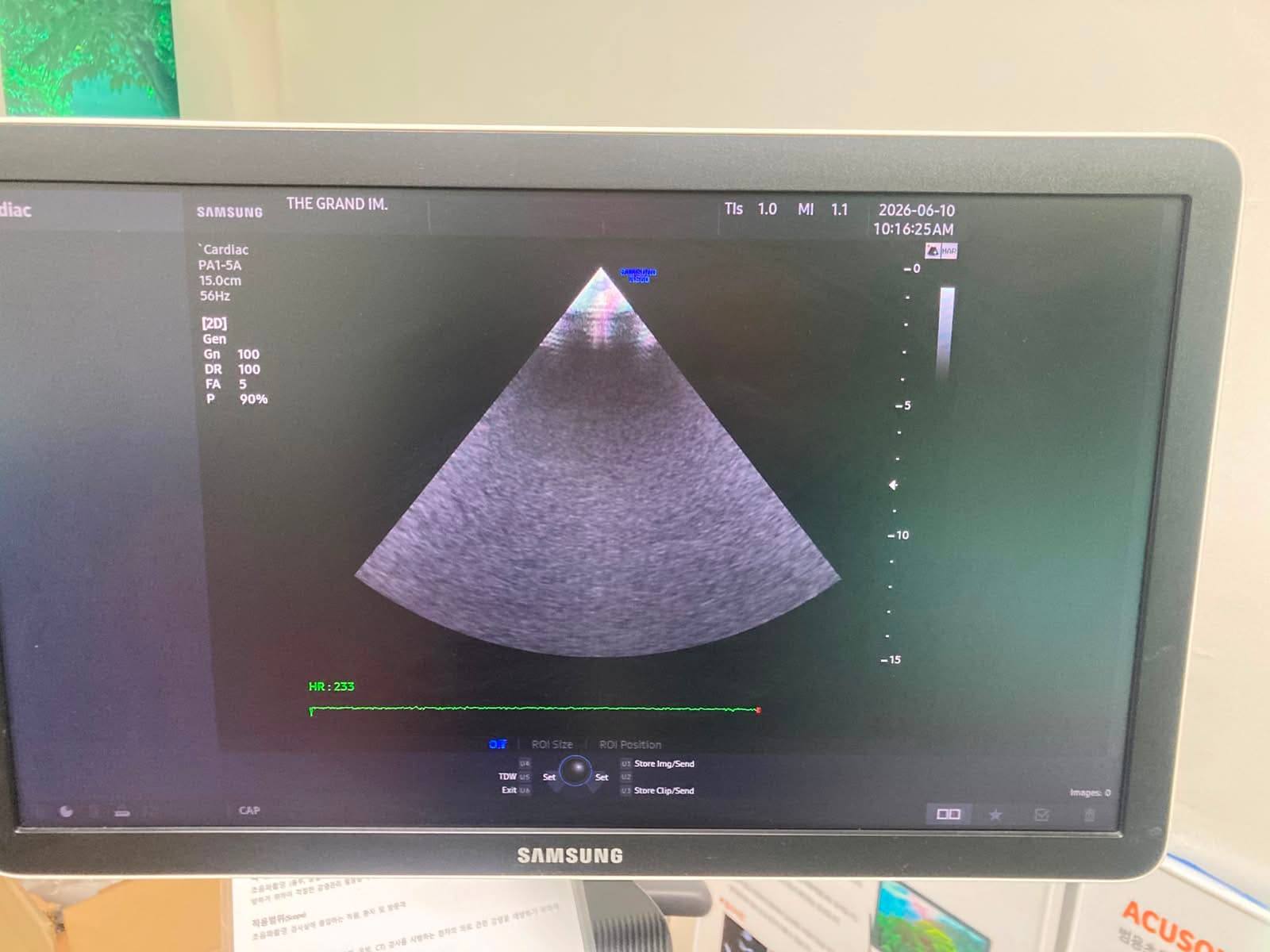 Samsung Medison HS60 Premium Ultrasound System with LA3-14AD PA1-5A CA1-7AD Probes Excellent Condition thumbnail 7