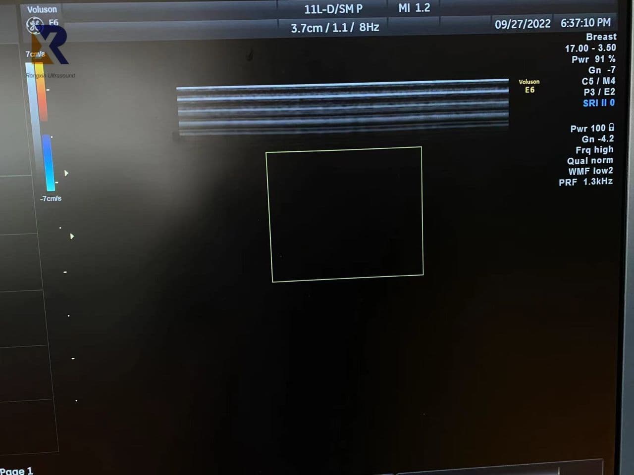 GE 11L-D Linear Array Ultrasound Transducer thumbnail 3