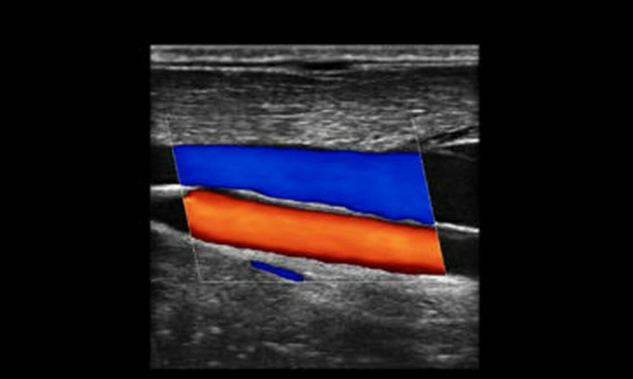 SonoScape X5 Portable Ultrasound System thumbnail 6
