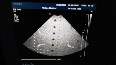 Philips S4-1 Sector Ultrasound Transducer for iU22 Systems thumbnail 4