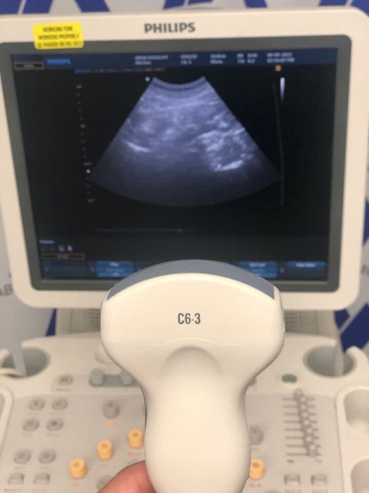 Philips HD9 Ultrasound System with C6-3 and V9-4v Transducers thumbnail 2
