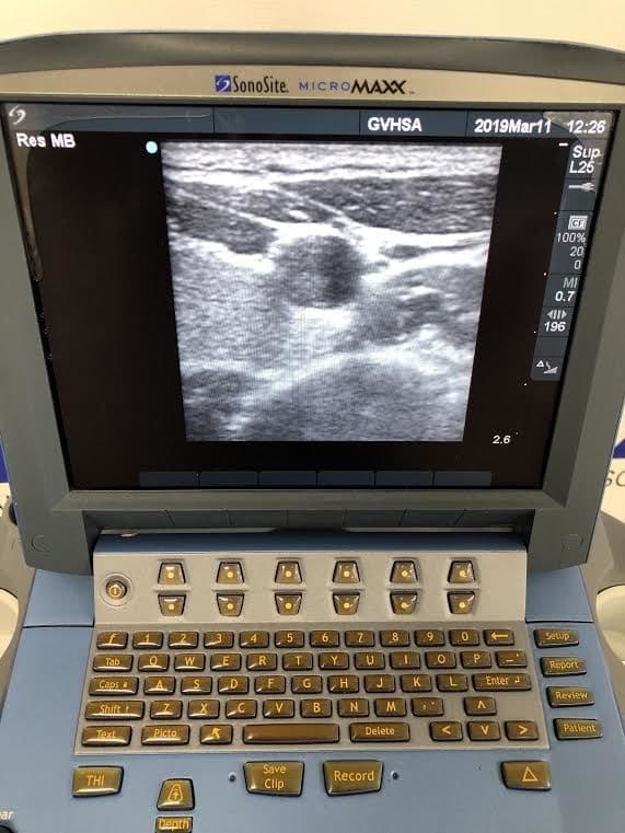 Sonosite L25e Linear Ultrasound Transducer Probe thumbnail 3