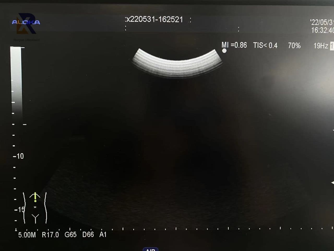 Aloka UST-9130 Convex Array Ultrasound Transducer thumbnail 3