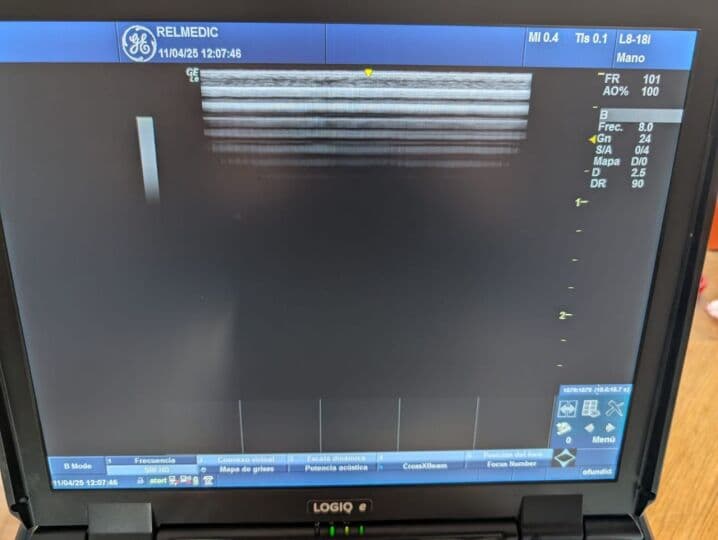 GE L8-18i-RS Intraoperative Stick Ultrasound Transducer thumbnail 7