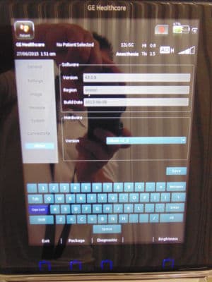 GE Venue 40 BT12 Point-of-Care Ultrasound System thumbnail 6