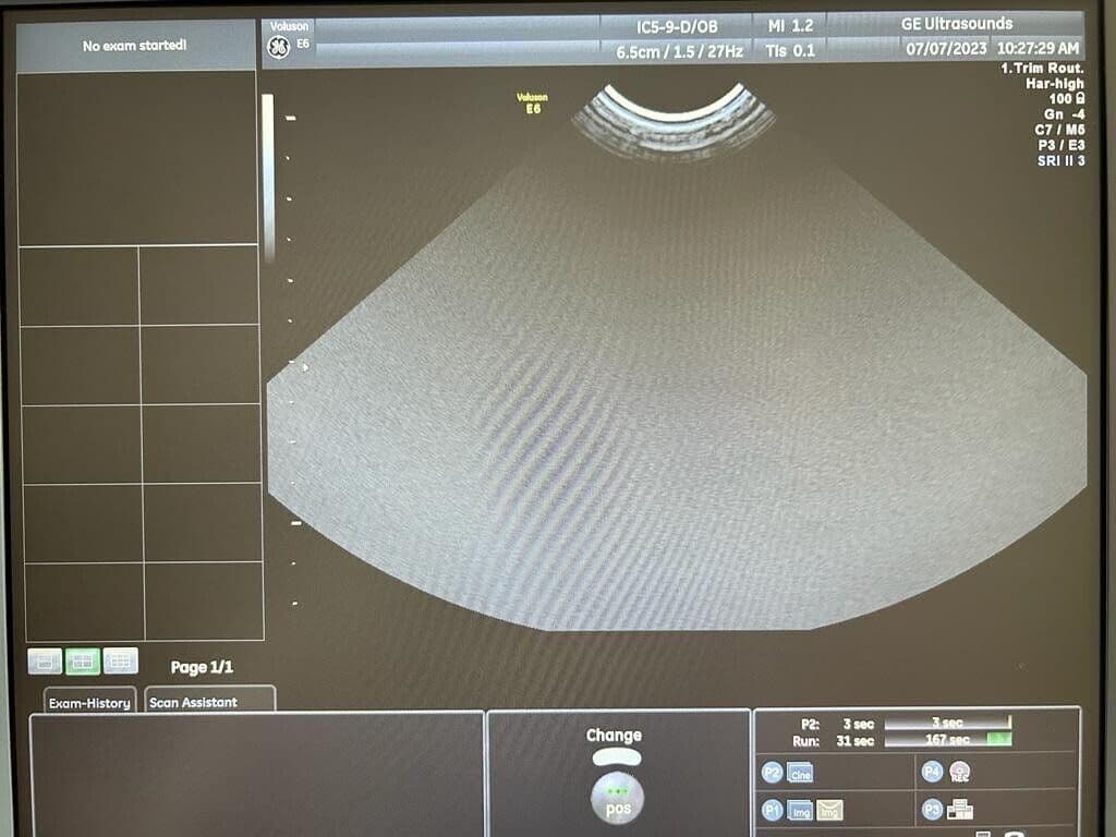 GE IC5-9-D Intracavitary Ultrasound Transducer thumbnail 6