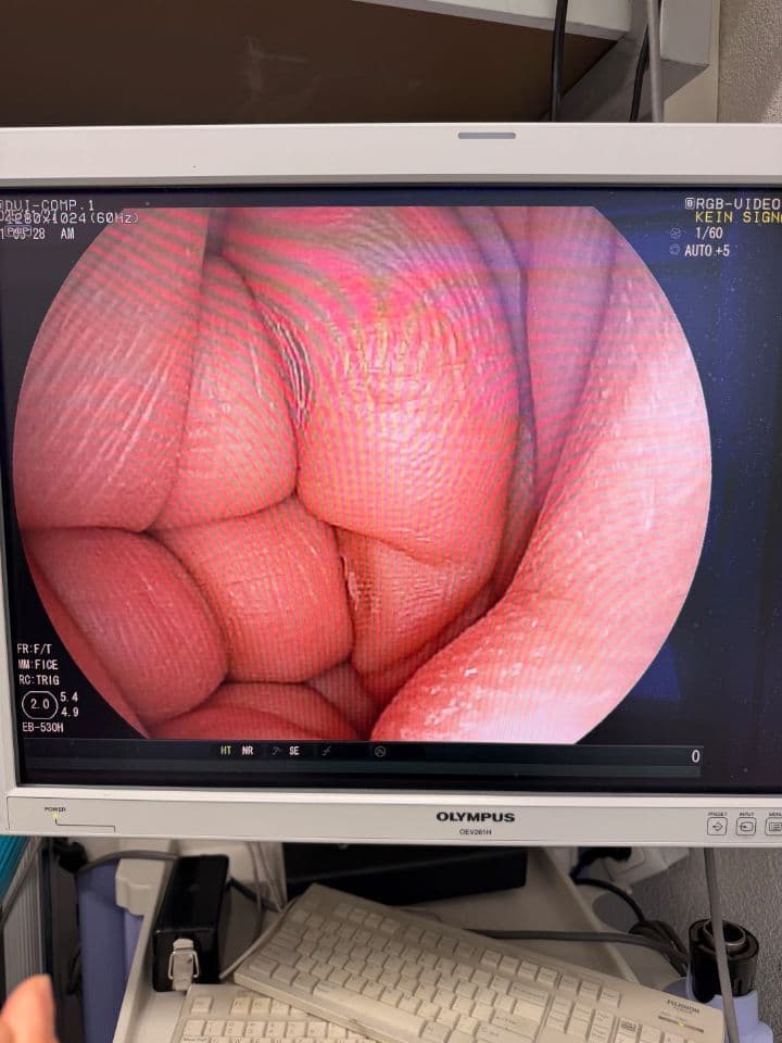 For Sale FUJINON EB-530H Bronchoscope thumbnail 5