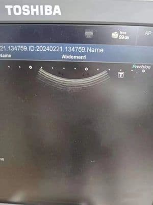 Toshiba PVU-375BT Convex Array Ultrasound Transducer thumbnail 3