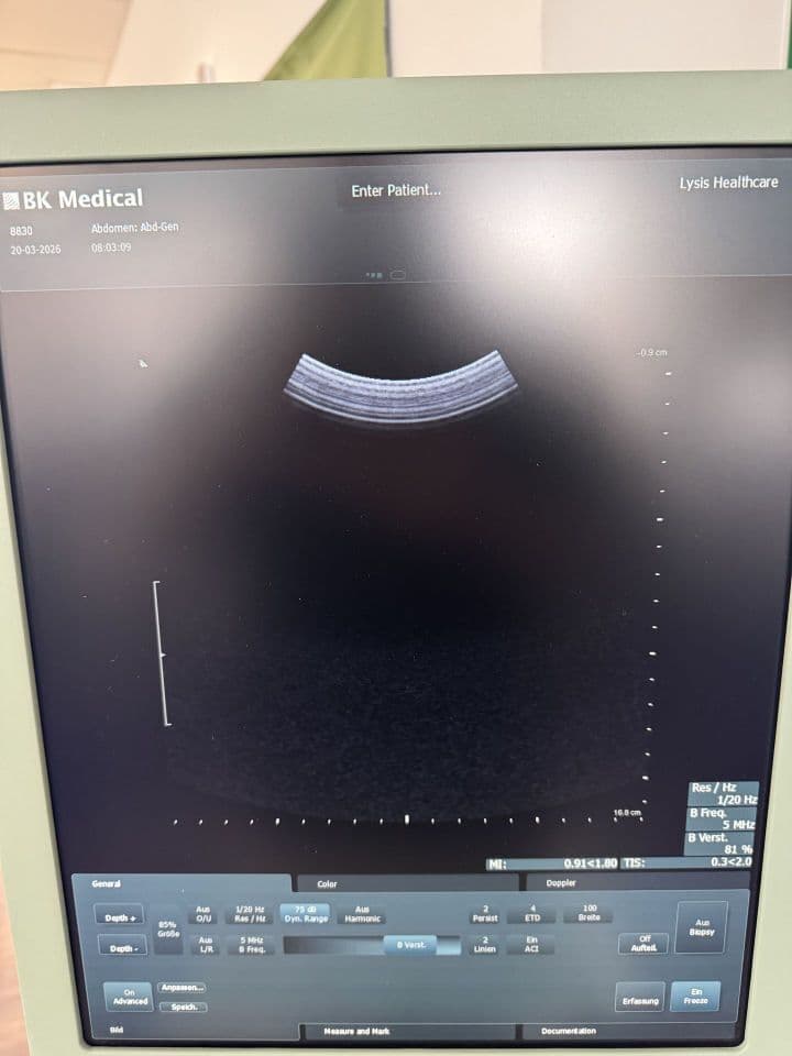 For Sale BK MEDICAL Flex Focus 400 Urology Ultrasound thumbnail 2