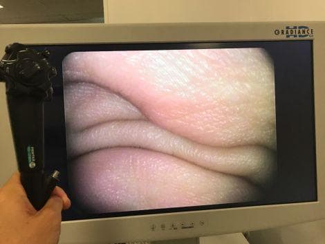 PENTAX EPK-i Video Processor and Xenon Light Source for Endoscopy thumbnail 4