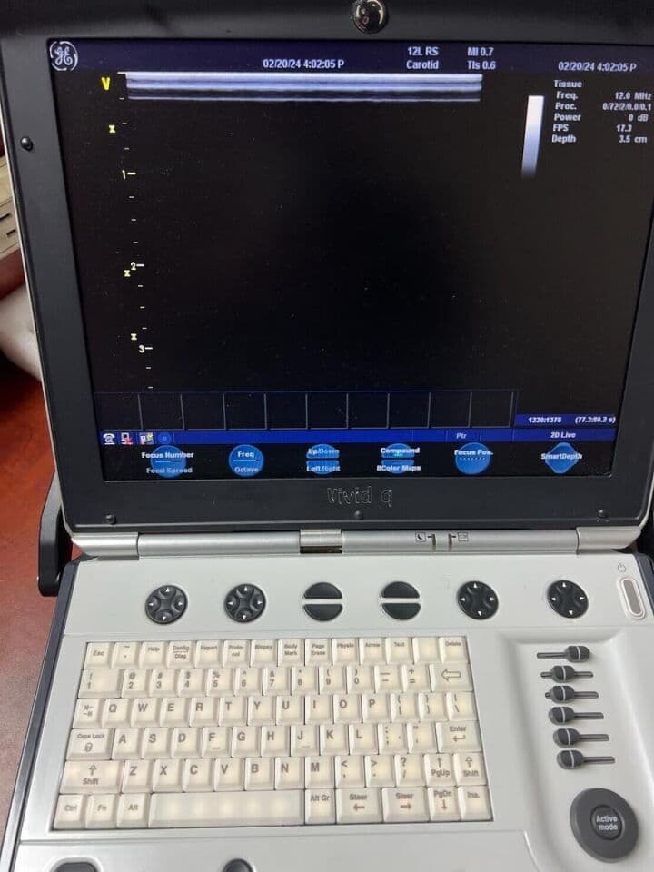 GE Vivid Q Portable Echocardiography Ultrasound System thumbnail 7