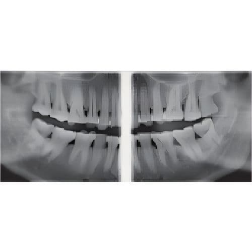Sirona Orthophos XG Pan Panoramic Dental X-Ray System thumbnail 3