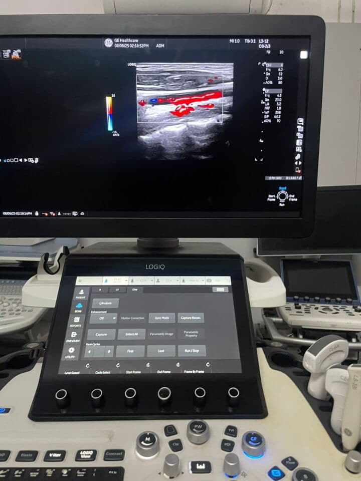 GE Logiq E20 General Ultrasound System image 1
