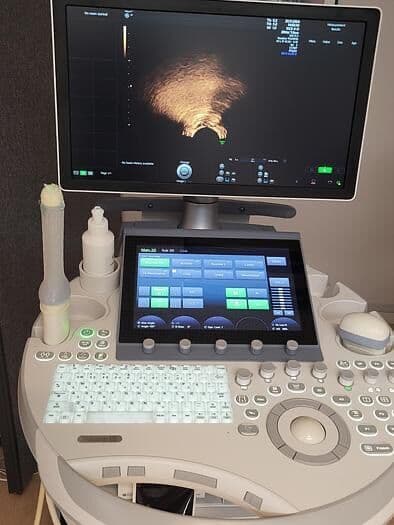 GE Voluson E8 OB/GYN Ultrasound System image 1