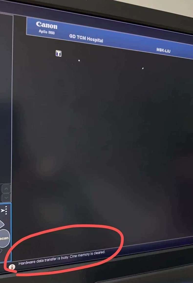 Canon / Toshiba Aplio i700 / i800 / i900 RX-RC & TX Board Repair Service (Hardware Data Transfer Busy / Cine Memory Cleared / Image Artifact / No Image / Signal Error) thumbnail 4
