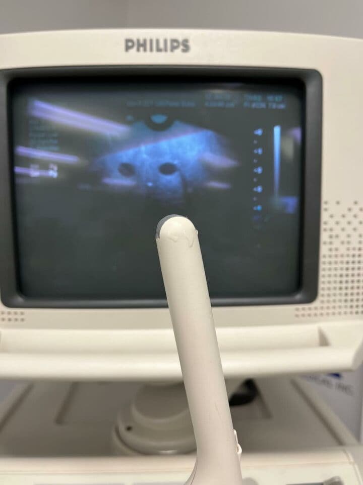 Philips HDI 5000 Ultrasound System with Three Probes thumbnail 7