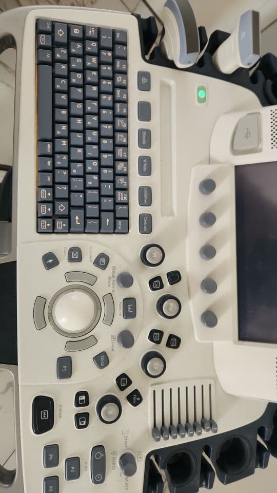 Versatile OB/GYN and Vascular Ultrasound System: The GE Logiq E9 thumbnail 3