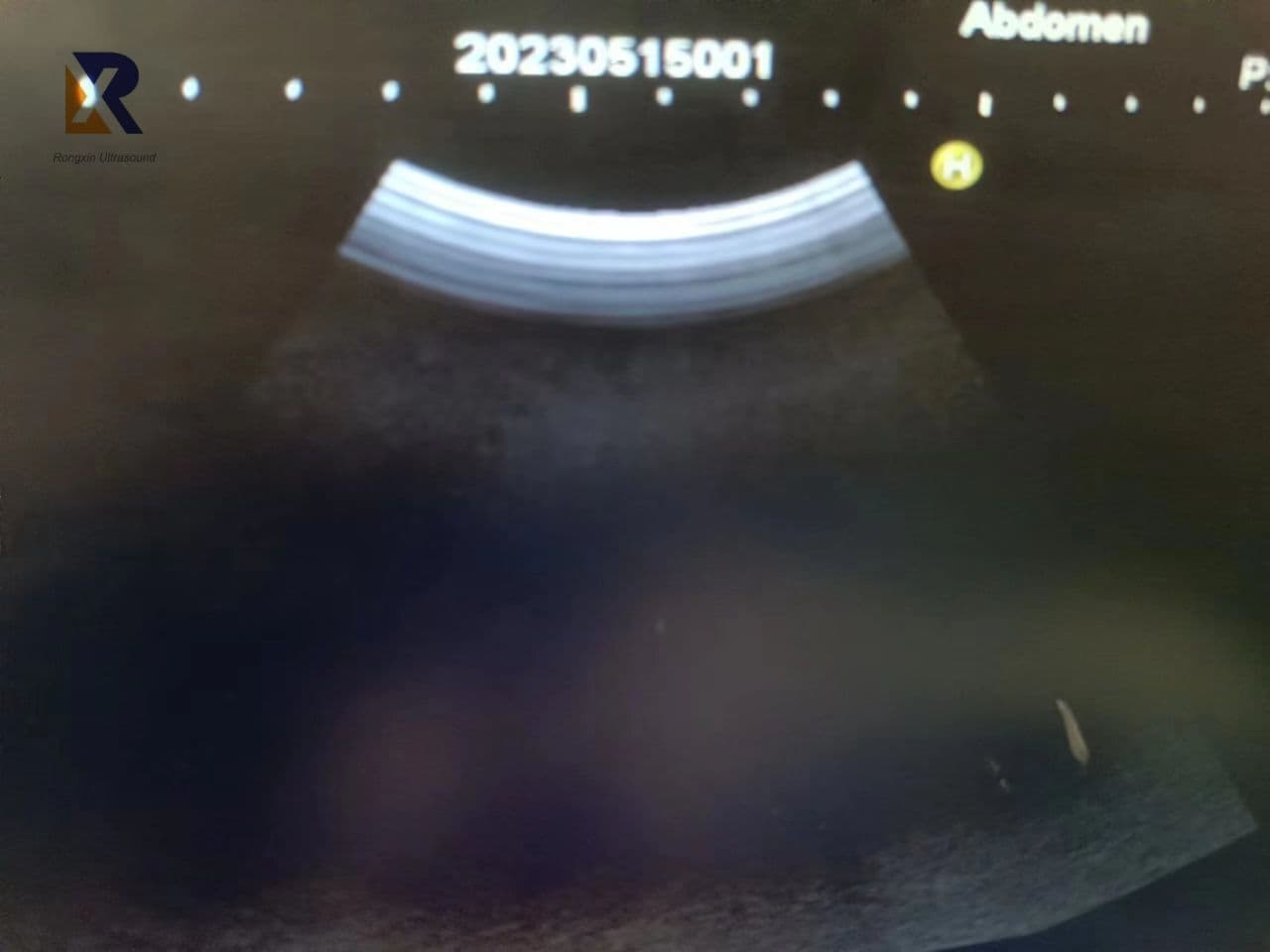 Hitachi EUP-C715 Curved Array Ultrasound Transducer thumbnail 5