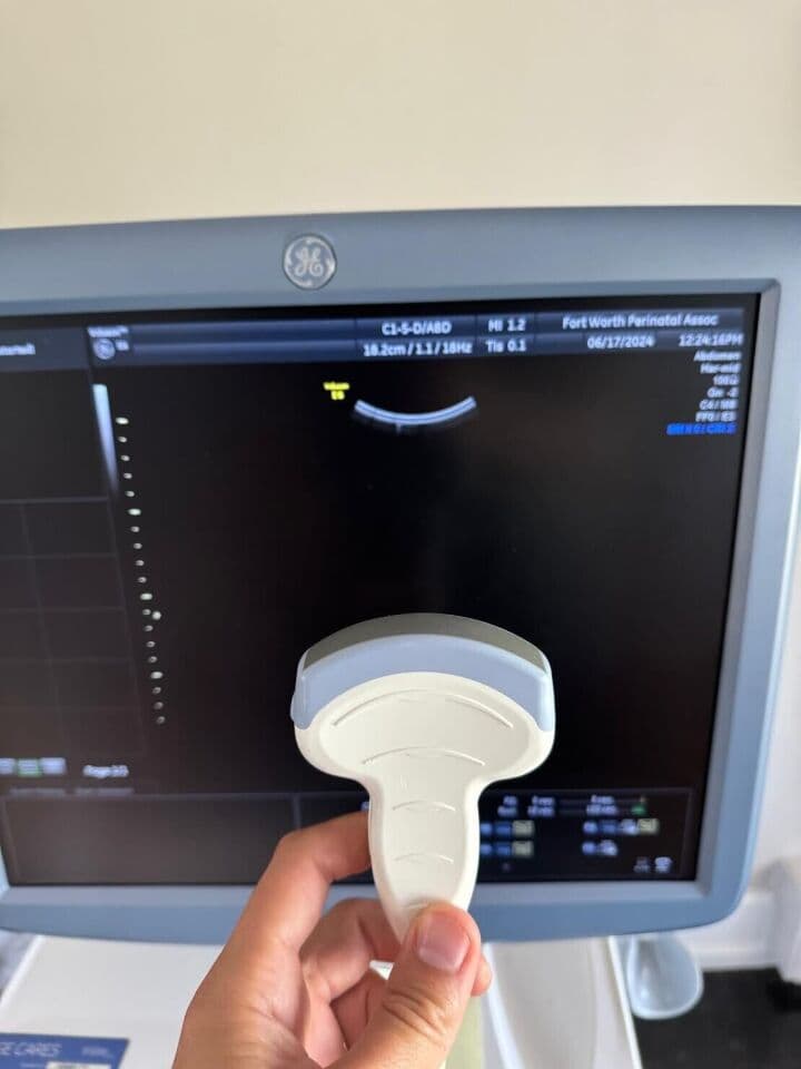 GE Voluson E6 3D/4D Ultrasound System thumbnail 3