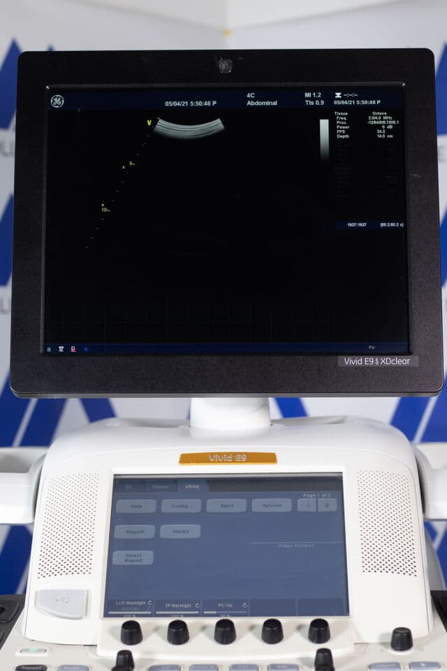 GE Vivid E9 XD Clear Cardiovascular Ultrasound System thumbnail 4
