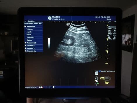 GE M6C-D Matrix Convex Ultrasound Transducer thumbnail 8