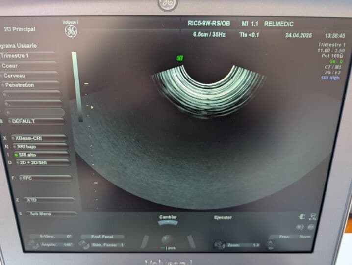 GE RIC5-9W-RS 3D/4D Endocavitary Ultrasound Transducer thumbnail 6