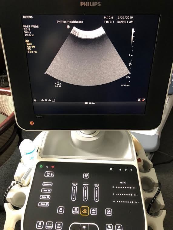 Philips C6-2 Curved Array Ultrasound Transducer thumbnail 2