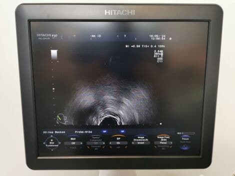Hitachi Aloka F-37 Ultrasound System with UST-9123, UST-568, and UST-9124 Probes thumbnail 10