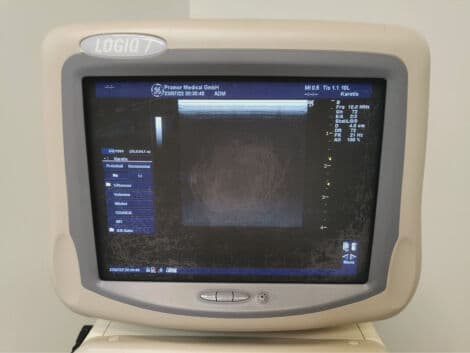 GE Logiq 7 Cardiac Ultrasound System thumbnail 5