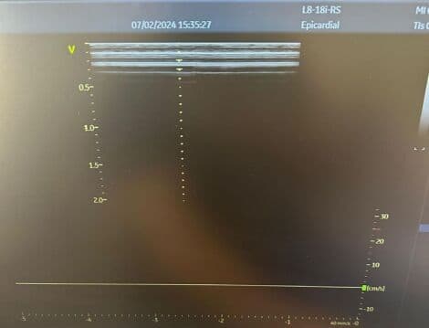 High-Frequency Linear Ultrasound Probe — GE L8-18i-RS for Vascular and Small Parts thumbnail 3
