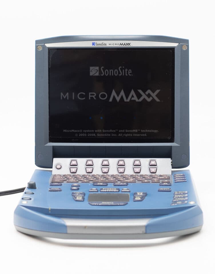 SonoSite MicroMaxx Portable Ultrasound System image 1