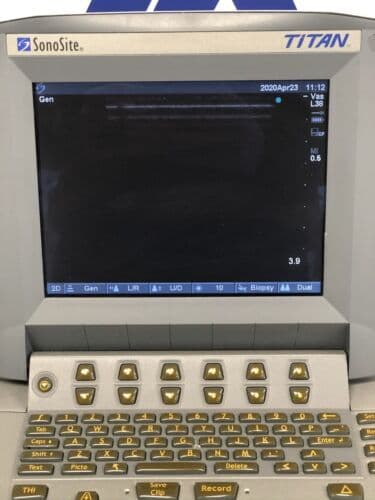 SonoSite TITAN Portable Ultrasound System with L38 Linear Array Probe thumbnail 2