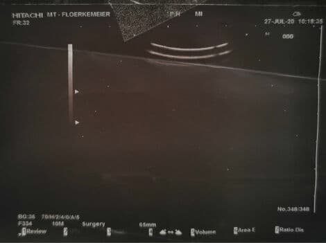 Hitachi EUP-F 334 Intraoperative Ultrasound Transducer thumbnail 2