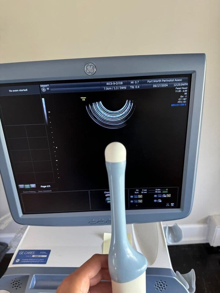 GE Voluson E6 3D/4D Ultrasound System thumbnail 4