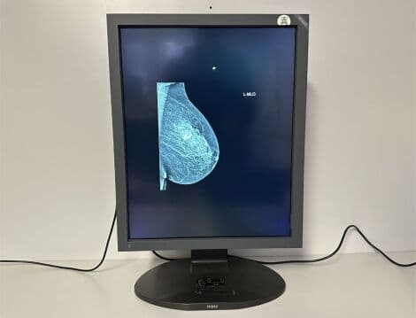 Diagnostic X-Ray Monitor by Totoku — ME511L / B thumbnail 3