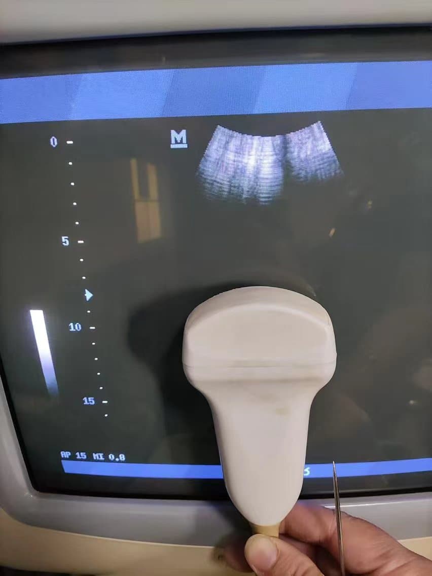 Sonoscape Convex Transducer C344 thumbnail 7
