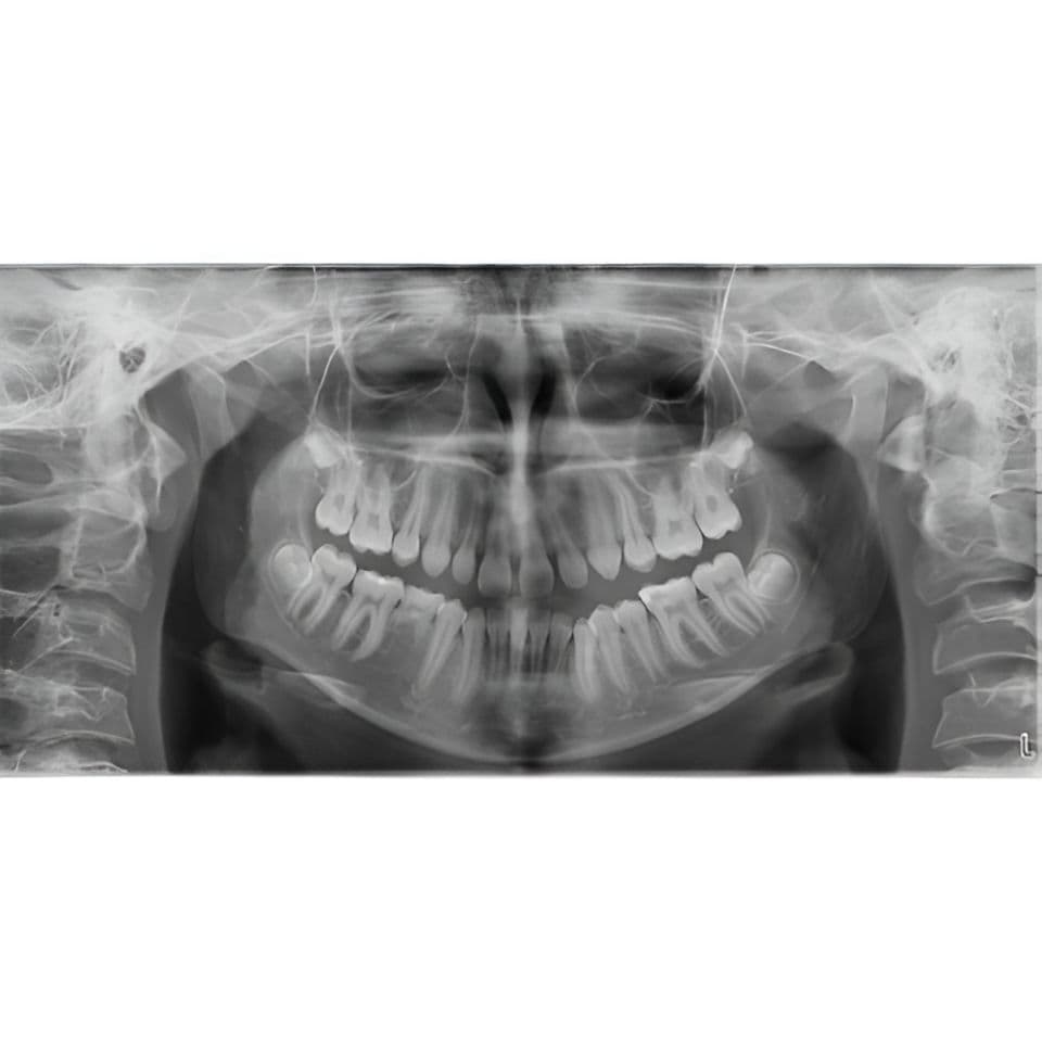 Planmeca ProMax Pan Dental X-Ray System thumbnail 14